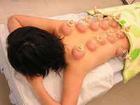 吸角療法